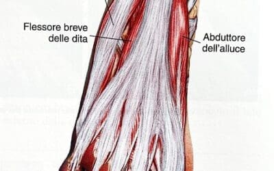 Fascite plantare